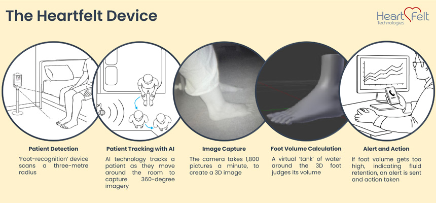 The Heartfelt Device process chart showing 5 stages: patient detection; patient tracking with AI; image capture; foot volume calculation; and the alert and action stage